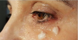 Aplica aceite de coco alrededor de tus OJOS 5 min mas tarde no creerás sus BENEFICIOS