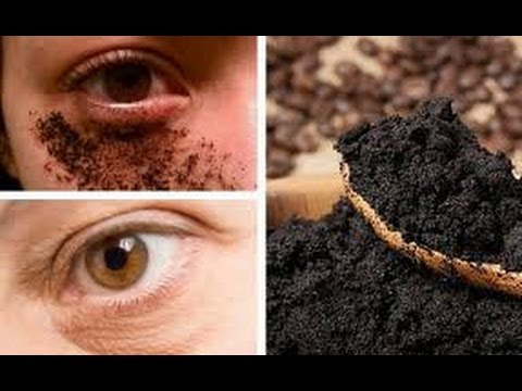 Cómo Eliminar Las Arrugas De Los Ojos De Forma Rápida Y Natural