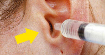 INCREÍBLE, COMO SE DESTAPAN TUS OÍDOS EN SEGUNDOS CON ESTE REMEDIO CASERO