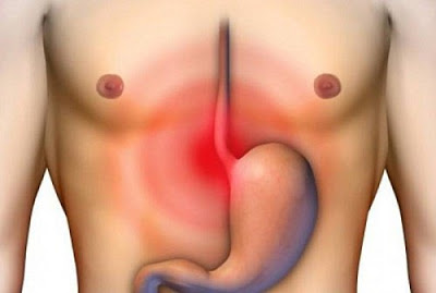 REMEDIOS CASEROS DESINFLAMAR EL ESTÓMAGO Y ACABAR CON LA COLITIS.