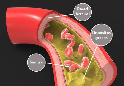 Tienes los triglicéridos altos mira como bajarlos naturalmente
