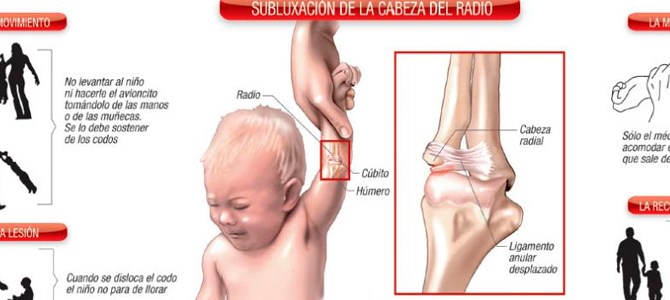 Mucho cuidado con los jalones del brazo en los niños (codo de niñera)