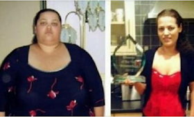 Pensando que iba a morir, ella comenzó a comer esto y perdió increíblemente 125 Kilogramos.!