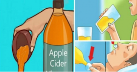 Beber vinagre de manzana antes de acostarse va a cambiar su vida para siempre.!