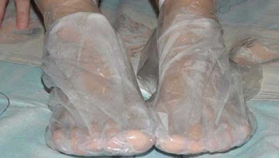Dile adiós a eso molestos y feos callos de los pies con este sorprendente remedio natural