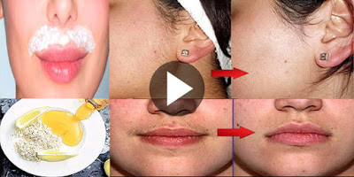 Mascarilla casera para eliminar el vello facial