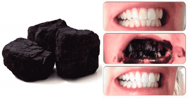 métodos naturales de limpieza que eliminarán el sarro de tus dientes