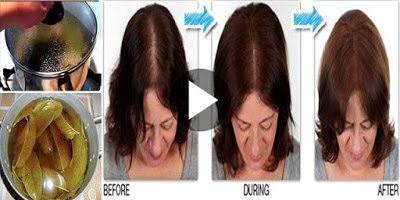 10 Remedios caseros para detener la caída del cabello con ingredientes totalmente naturales!
