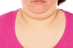 3 formas de disminuir la papada y tonificar el cuello rapidamente.