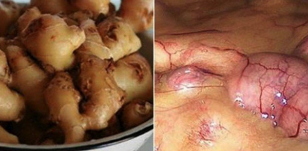 ESTO ES LO QUE HACE EL JENGIBRE EN SU CUERPO SI USTED LO COME TODOS LOS DÍAS
