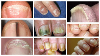 Lo Que el Color De Tus uñas Puede Revelar Sobre Tu Salud