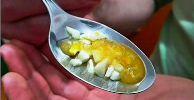 El Remedio Natural a Base de Miel y Ajo que están recomendando todos los Médicos