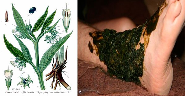 SORPRENDE AL MUNDO EL EFECTO DE ESTA PLANTA..CAPAZ DE ALIVIAR HERIDAS Y FRACTURAS EN TIEMPO RÉCORD!!!