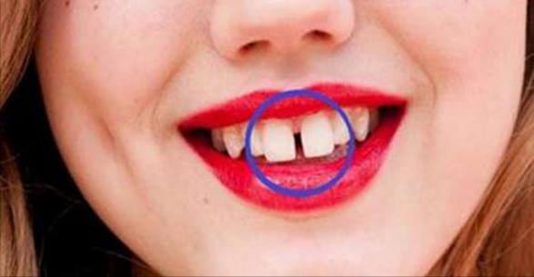 Si tienes los dientes separados o conoces a alguien que los tenga, tienes que leer esto urgentemente!