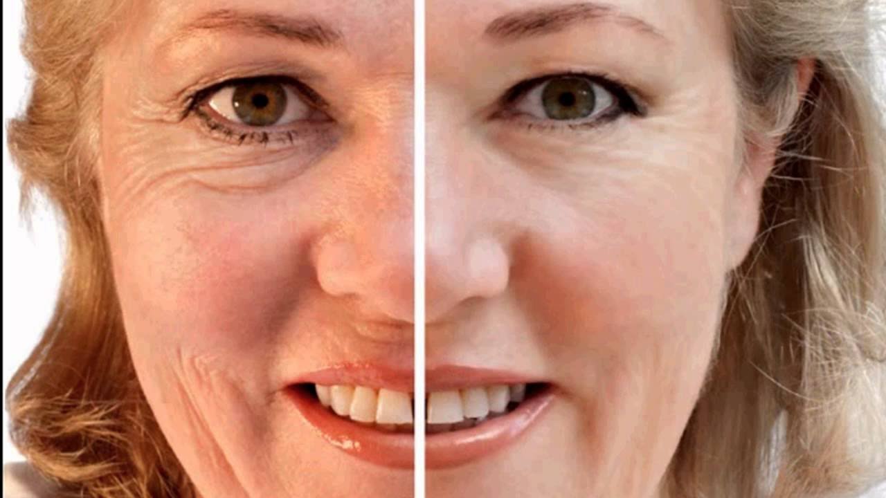 Cómo quitar las arrugas en sólo 7 días con esta receta natural eficaz!