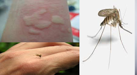 Es usted un imán de los mosquitos aquí les explicamos por que y como evitarlo. Mira..