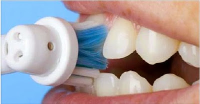 Como podemos limpiar los dientes y eliminar la placa de manera naturalmente…!!!