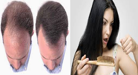 Remedios caseros para la pérdida del cabello, realmente funciona! fácil de a ser..!