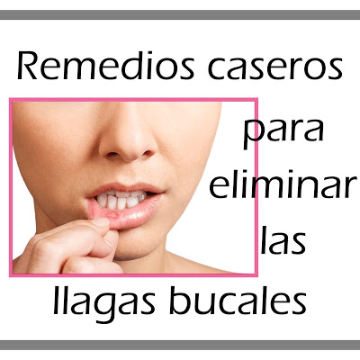 Remedios caseros para eliminar las llagas