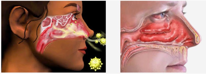 ¿sabias que el color de tu mucosidad tiene un significado?