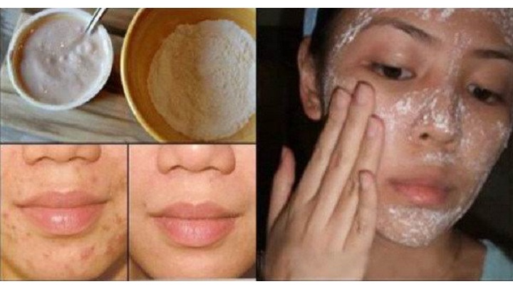 Te Vamos A Mostrar Como Se Mesclar El Bicarbonato De Sodio, Para Tratar Las Arrugas, Manchas Y Ojeras En La Cara